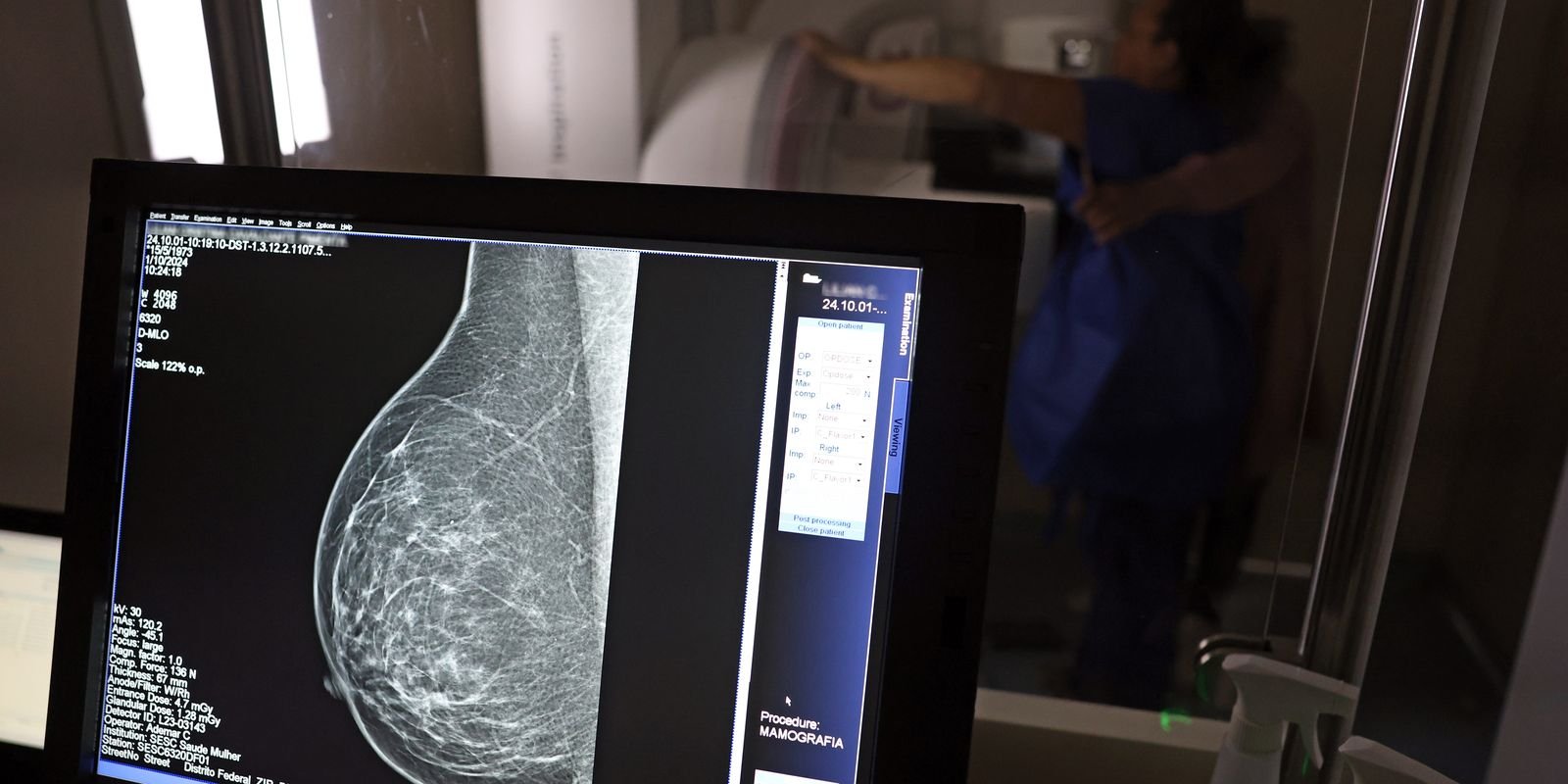 Ministério da Saúde passa a recomendar mamografia a partir dos 40 anos