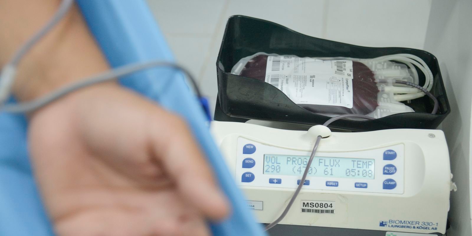 Crianças com hemofilia terão terapia menos invasiva pelo SUS