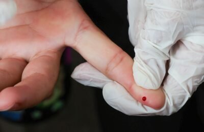 Brasil atinge meta de redução da transmissão vertical de hepatite B