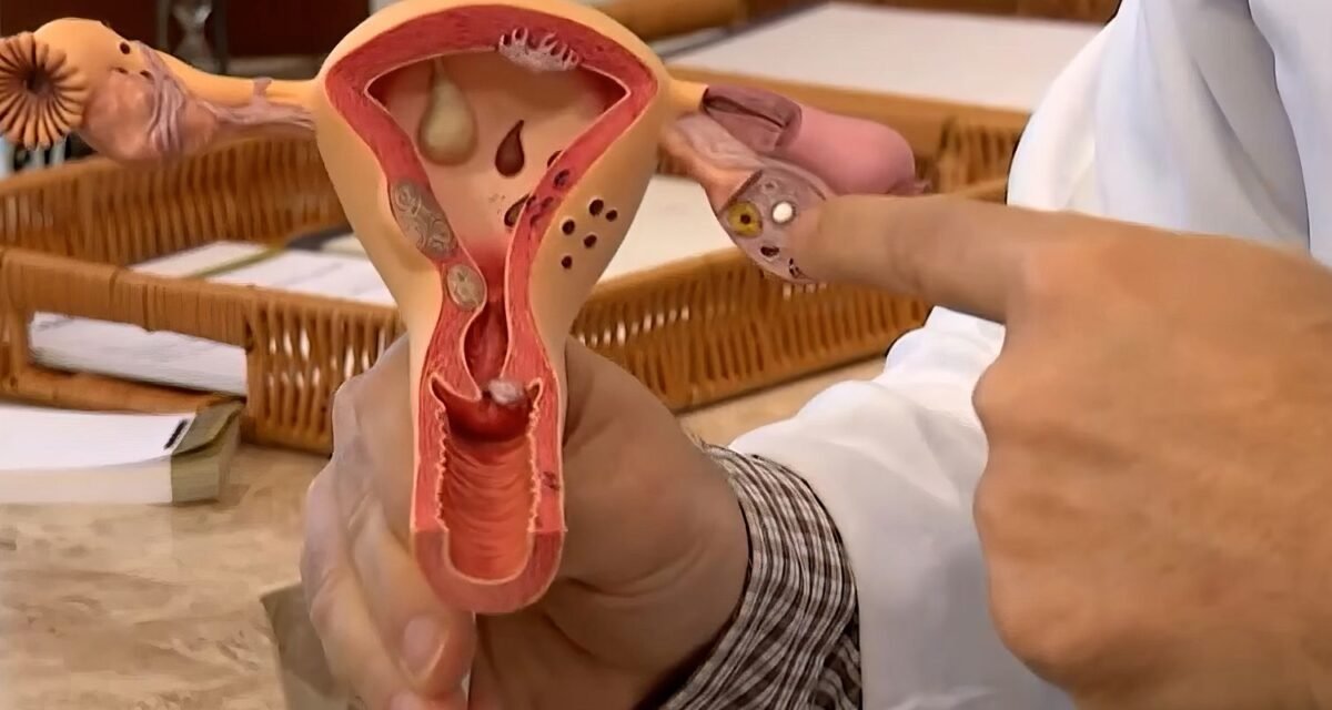 Aberta chamada pública para pesquisas sobre endometriose