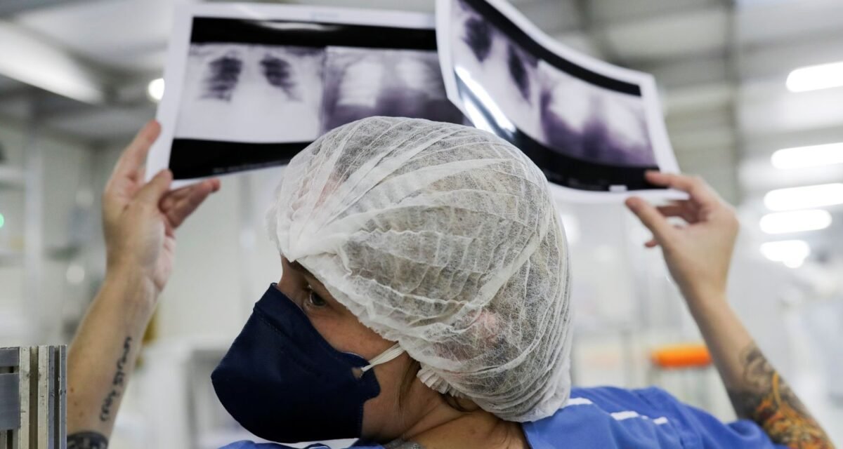 Diagnóstico tardio dá poucas chances de cura do câncer de pulmão