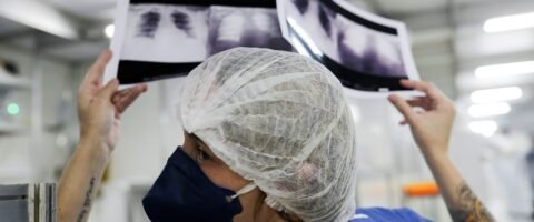 Diagnóstico tardio dá poucas chances de cura do câncer de pulmão