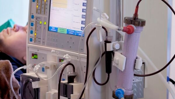 Estudo alerta para subdiagnóstico da doença renal crônica no Brasil