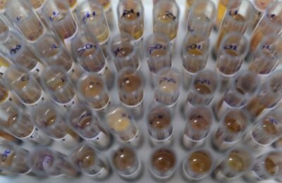 Uso de medicamento oferecido no SUS reduz casos de malária no Brasil