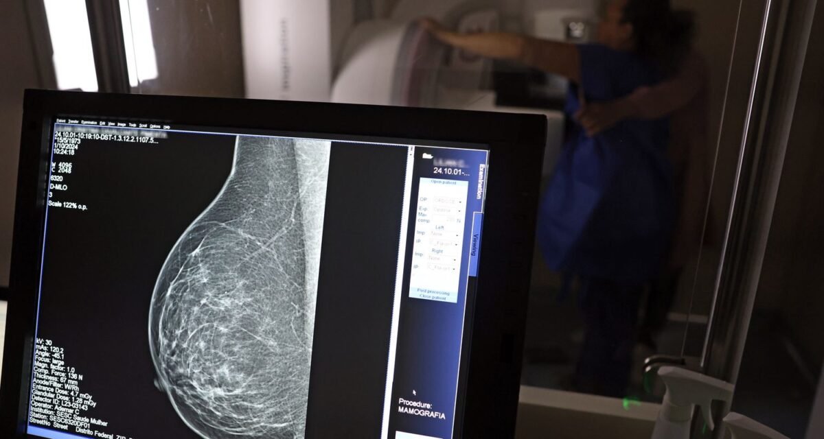 Plano de saúde terá que cobrir mamografia digital para todas as idades