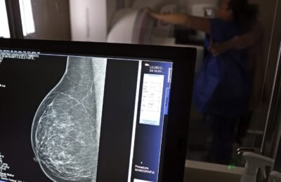 Entidades alertam médicos sobre pedidos de mamografia digital