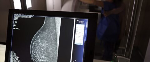 Entidades alertam médicos sobre pedidos de mamografia digital