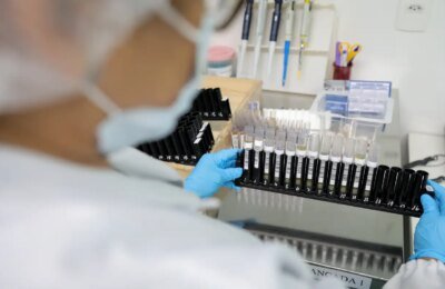 Malária: Anvisa autoriza teste em humanos de vacina 100% brasileira