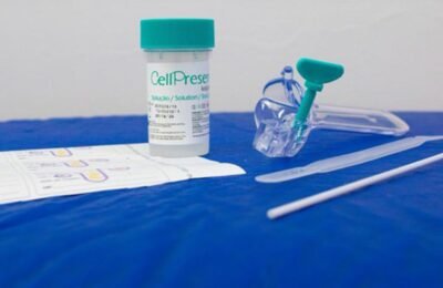 SUS detecta quase 10 mil testes positivos para HPV de alto risco